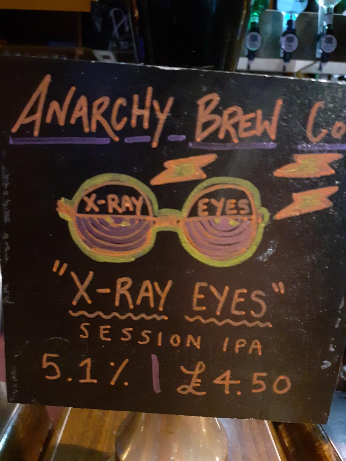 X-Ray Eyes